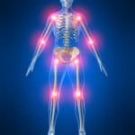 diagram of joint support system in body