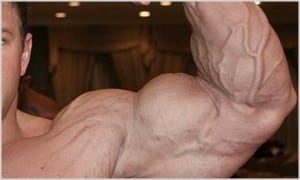 steroid stretch marks