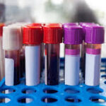 A Comprehensive Look at Lab Tests