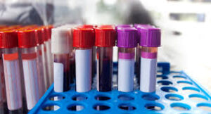 - Steroid Labs - Hormone Testing - Testosterone Levels - Estrogen Levels - Blood Work - Liver Function Tests - Lipid Panel - Cholesterol Levels - CBC (Complete Blood Count) - Hematocrit - Hemoglobin - Kidney Function Tests - Creatinine - ALT (Alanine Aminotransferase) - AST (Aspartate Aminotransferase) - SHBG (Sex Hormone-Binding Globulin) - Free Testosterone - Total Testosterone - Estradiol - Prolactin - Cortisol Levels - IGF-1 - HPTA Function - Hormonal Balance - Thyroid Panel - TSH (Thyroid-Stimulating Hormone) - Insulin Sensitivity - Blood Pressure - FSH (Follicle-Stimulating Hormone) - LH (Luteinizing Hormone) - PSA (Prostate-Specific Antigen) - DHT (Dihydrotestosterone) - Lipoproteins - Glucose Levels - Triglycerides - Androgen Levels - Cardiovascular Health - Endocrine Monitoring - Steroid Use Safety - Anabolic Testing