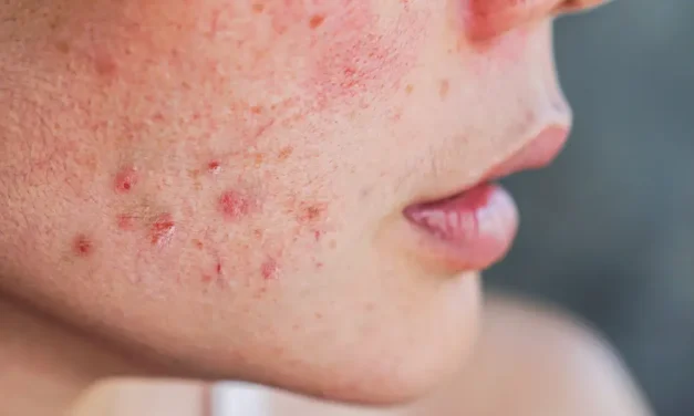 Testopel, the Ideal Testosterone Replacement