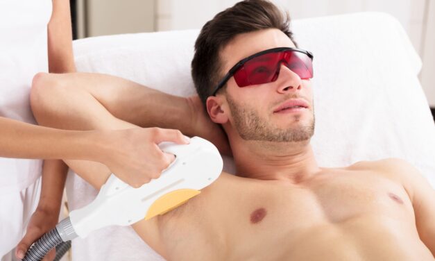 Laser Hair Removal and Men by 3J