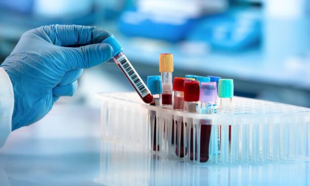 Blood Work is Essential During a Steroid Cycle