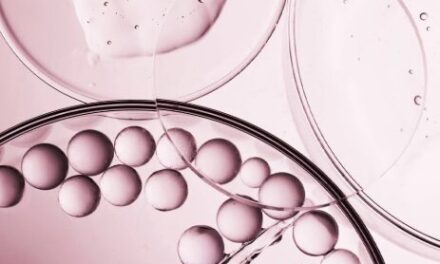 Collagen Peptides for Joint and Tendon Health in Bodybuilding
